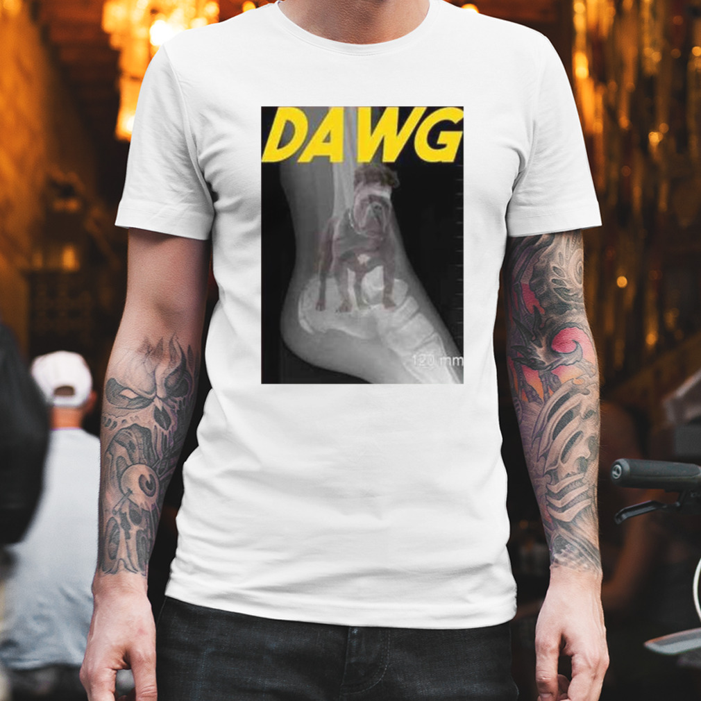Patrick Mahomes Dawg Ankle X Ray Football Shirt